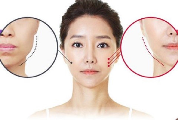 Quy trình thu gọn hàm bằng Botox chuẩn chỉnh tại Dr Korea