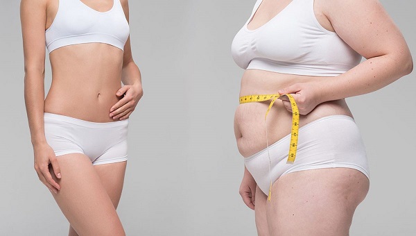 Trước và sau khi giảm béo toàn thân 