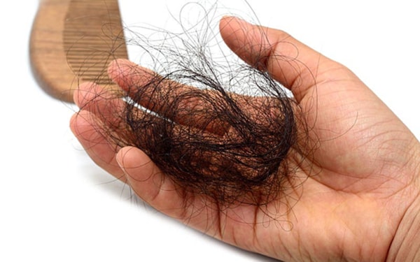 Những ảnh hưởng xấu khi rụng tóc sau sinh bạn cần biết