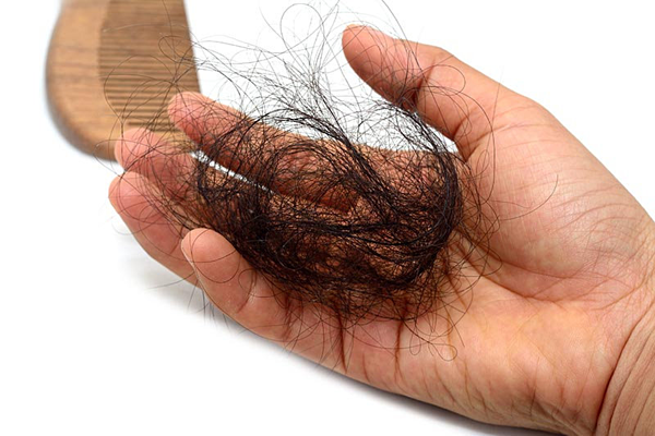 Cách ngăn ngừa rụng tóc bằng cấy tinh chất mọc tóc Mesotheraphy đang rất hot hiện nay 