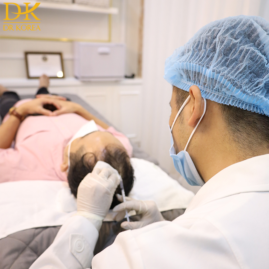Điều trị rụng tóc hiệu quả ở nam giới bằng phương pháp cấy Mesotherapy