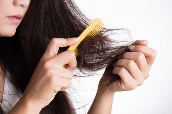 Rụng tóc androgen là gì và cách điều trị hiệu quả nhất