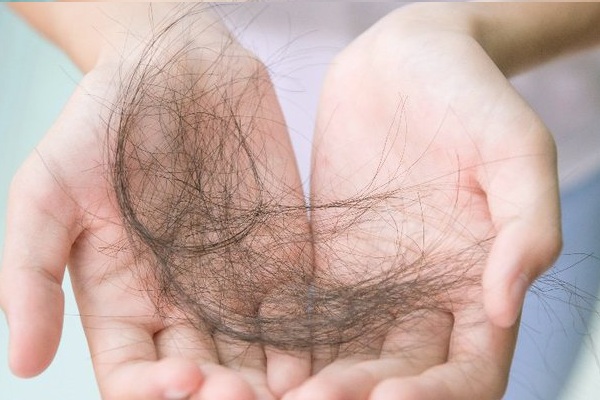 Rụng tóc sau sinh do nhiều nguyên nhân khác nhau gây nên