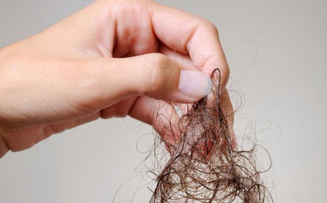 Cấy tinh chất mọc tóc Mesotherapy rất phổ biến hiện nay