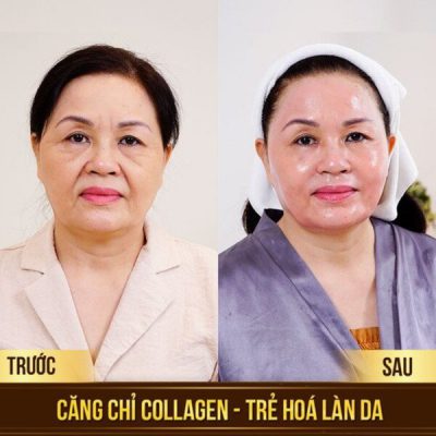 anh-bia-cang-chi-collagen-uy-tin